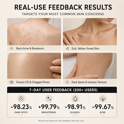 💖💖Oriivelle Niacinamide Brightening Soap, With Alpha‑Arbutin & Tranexamic Acid, Fade Dark Spots & Post‑Acne Marks, Gentle Deep Cleansing Bar For All Skin Types